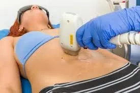 La depilación láser femenina: proporción, cuidado y belleza consciente